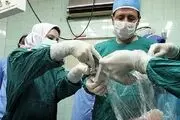 پیوند موفقیت آمیز انگشت به شکم بیمار