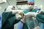 پیوند موفقیت آمیز انگشت به شکم بیمار