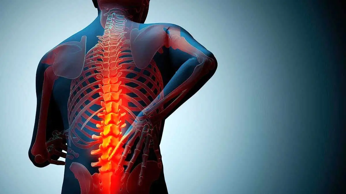 از هر ۳ زن و هر ۵ مرد در جهان یک نفر مبتلا به پوکی استخوان است
