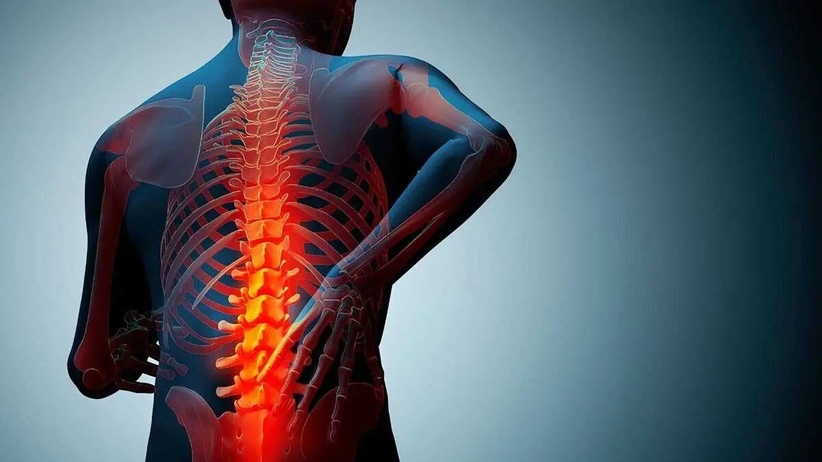 از هر ۳ زن و هر ۵ مرد در جهان یک نفر مبتلا به پوکی استخوان است
