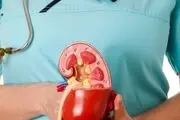 بررسی تاثیر کاکل ذرت در دفع سنگ‌ کلیه
