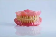دندان مصنوعی، انواع مارک‌ها، مزایا و معایب، قیمت