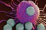 کشف دو علامت کلیدی ابتلا به سرطان روده
