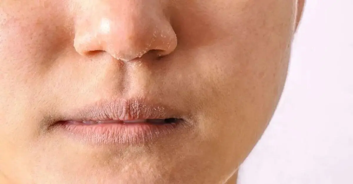 اگر می‌خواهید پوست شفاف و باطراوتی داشته باشید ببینید