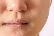 این خوراکی‌ها آب پوست شما را کم می‌کنند