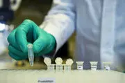 آغاز پروژه جمع آوری و ذخیره سازی پلاسمای افراد بهبود یافته از کرونا 