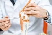پوکی استخوان از این سن شروع می‌شود
