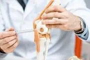 پوکی استخوان از این سن شروع می‌شود