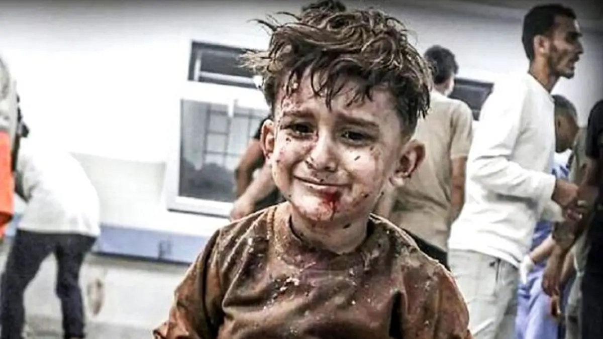شهادت ۳۰ کودک فلسطینی در غزه بر اثر سوء تغذیه