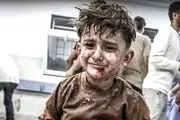 شهادت ۳۰ کودک فلسطینی در غزه بر اثر سوء تغذیه