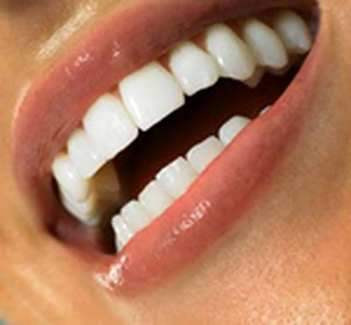 برای رفع بوی بد دهان چه کنیم؟