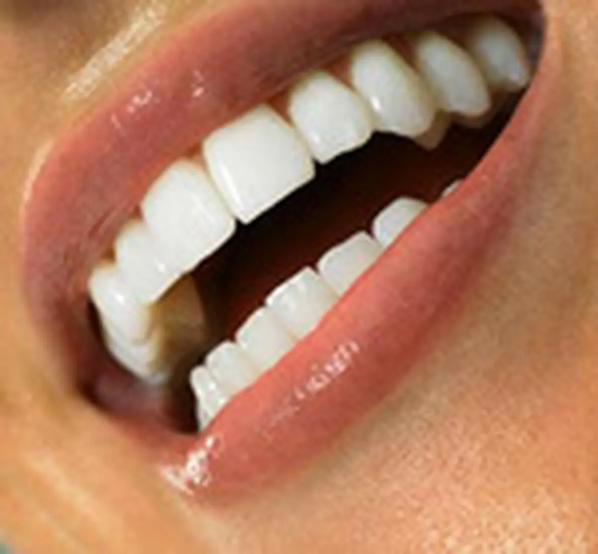 برای رفع بوی بد دهان چه کنیم؟
