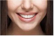 بهترین روش زیبایی دندان کدام است؟