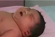 نوزادان سزارین بیشتر در معرض چاقی قرار دارند