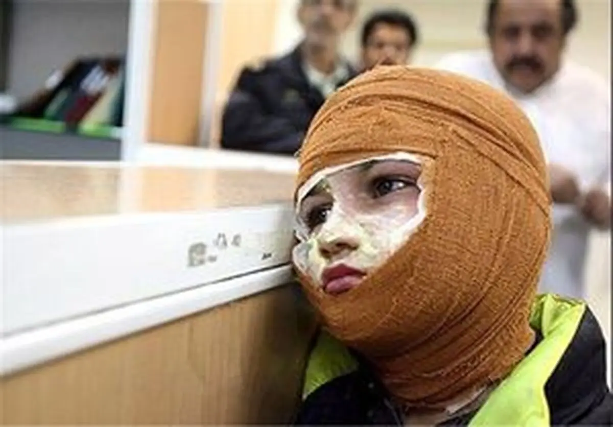 عوارض سوختگی‌های چهارشنبه سوری