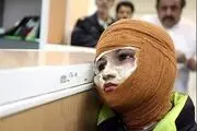عوارض سوختگی‌های چهارشنبه سوری