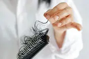 نسخه طب سنتی برای رفع ریزش موها