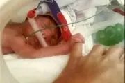 داستان ناتمام قصور پزشکی/این بار جان نوزاد در بدو تولد گرفته شد! 