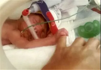 داستان ناتمام قصور پزشکی/این بار جان نوزاد در بدو تولد گرفته شد! 