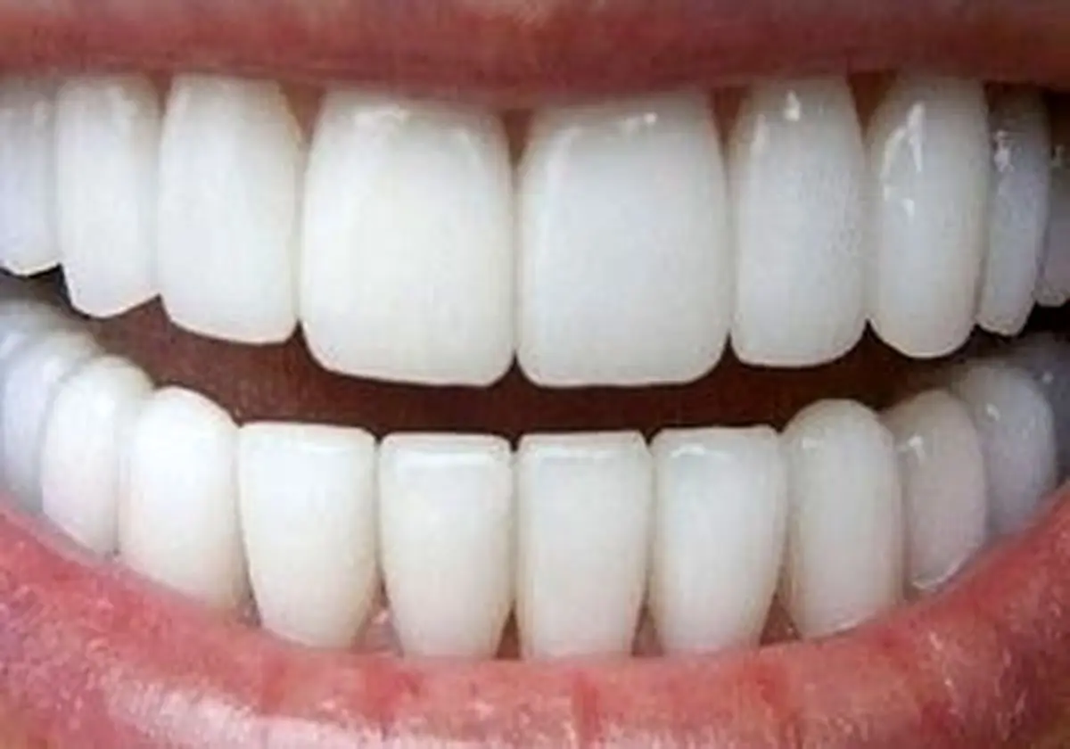 چگونه از بیماری های لثه و دندان پیشگیری کنیم؟
