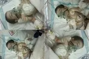 قصور پزشکی علی اصغر را به مرگ نزدیک کرد