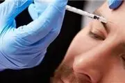 چه هنگام بوتاکس مفید خواهد بود؟