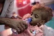 کودکان یمن در کام مرگ

