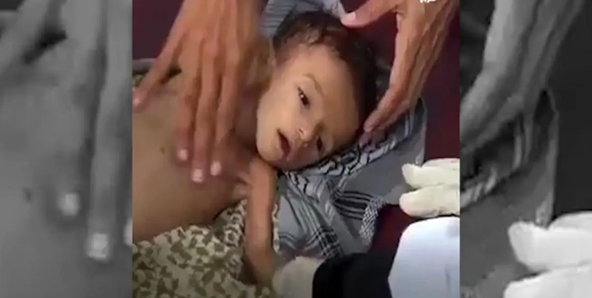 سناتور آمریکایی: 85 هزار کودک یمنی از گرسنگی و بیماری از بین رفتهاند