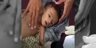 سناتور آمریکایی: 85 هزار کودک یمنی از گرسنگی و بیماری از بین رفته‌اند