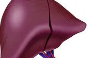 عوامل ابتلا به کبد چرب چیست؟