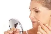 راهکاری آسان و طبیعی برای رفع خط اخم