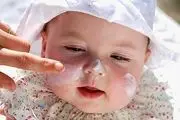 مراقبت از پوست کودک در فصل سرما
