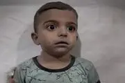 بلای وحشتناکی که جنگ بر سر کودکان فلسطینی آورد