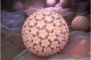ویروس اچ پی وی (HPV virus) یا پاپیلومای انسانی تناسلی در مردان
