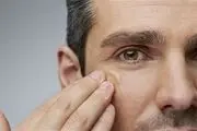 چرا باکتری‌ها و میکروب‌ها روی پوست تاثیری ندارند؟
