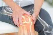 گام‌های ساده برای تقویت استخوان‌ها
