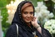 صورت پرُاز کک و مک «بهاره رهنما» /عکس