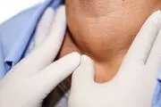 علائم تیروئید پرکار/ اینفوگرافی