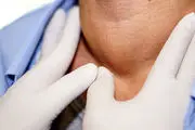 علائم تیروئید پرکار/ اینفوگرافی