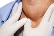 علائم تیروئید پرکار/ اینفوگرافی