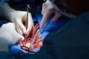 نحوه انجام عمل قلب باز
