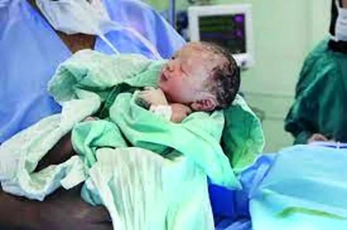 نقش ماماها در کاهش آمار سزارین و افزایش زایمان طبیعی