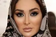 علت تغییر قیافه الهام حمیدی+فیلم