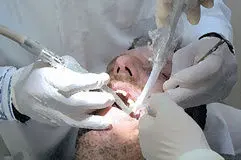 آیا دندان عقل را باید کشید؟