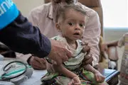 آمار تکان دهنده یونیسف درباره قربانی شدن کودکان یمنی