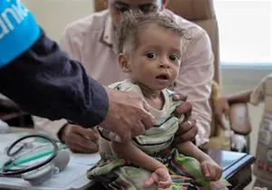 آمار تکان دهنده یونیسف درباره قربانی شدن کودکان یمنی