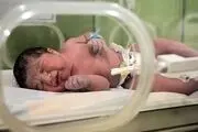 ارتباط آلودگی هوا با ۶ میلیون زایمان زودس