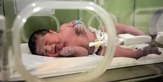 عوارض و تاثیر کرونا در نوزادان 