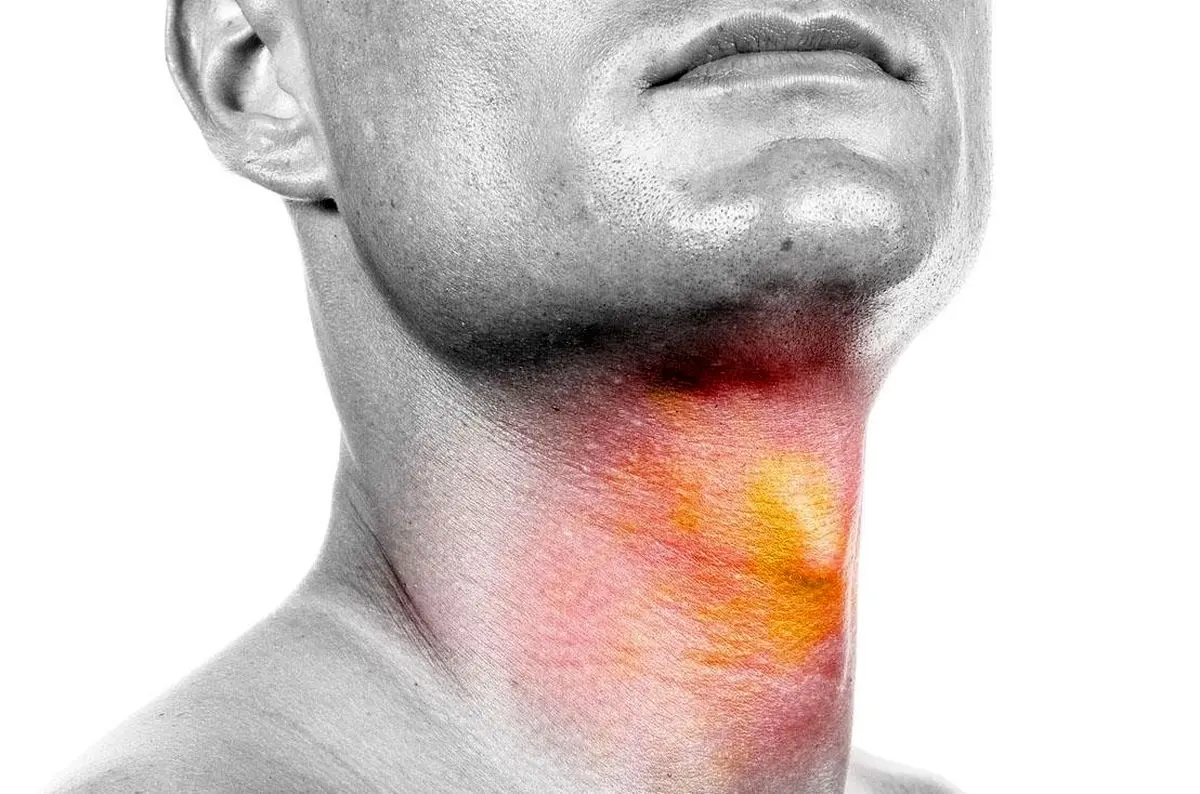 لزوم پیشگیری و تشخیص زودهنگام سرطانها در جهت درمان موثر