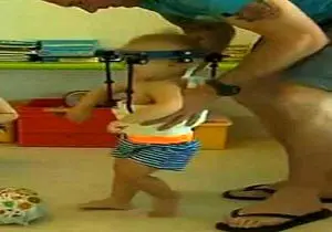 سر جداشده یک کودک به گردنش پیوند خورد